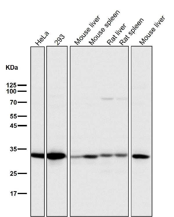 WB - Anti-active + pro Caspase 3 CASP3 Rabbit Monoclonal Antibody ABO14291